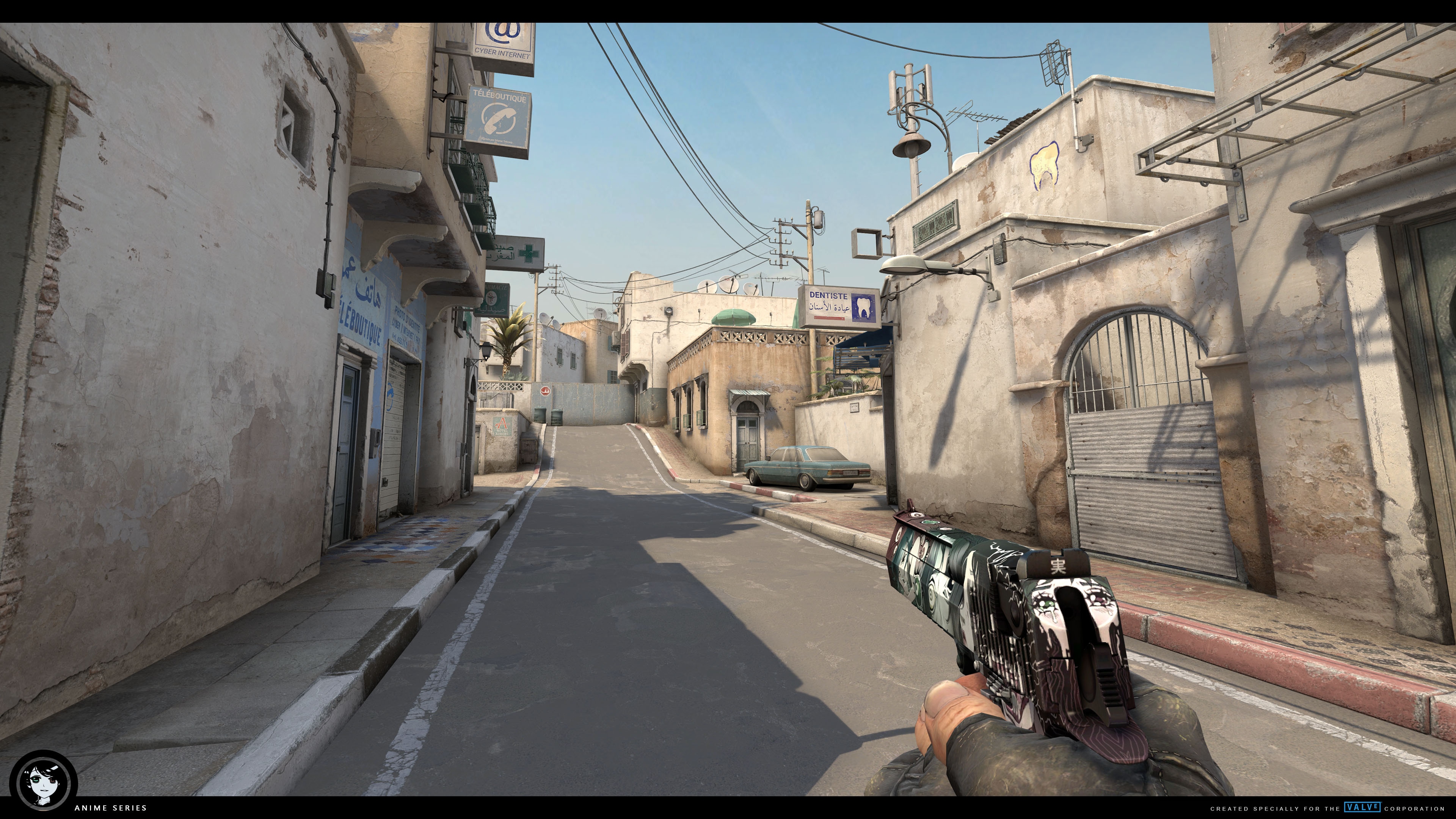 iG名宿秃子多？ rookie ：因为遗传的M型发型已植发